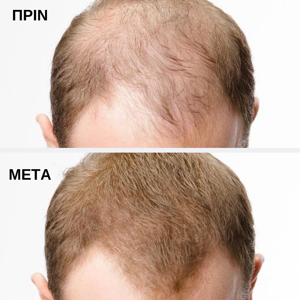 Toppik Hair Building Fibers Black 12gr - Image 4