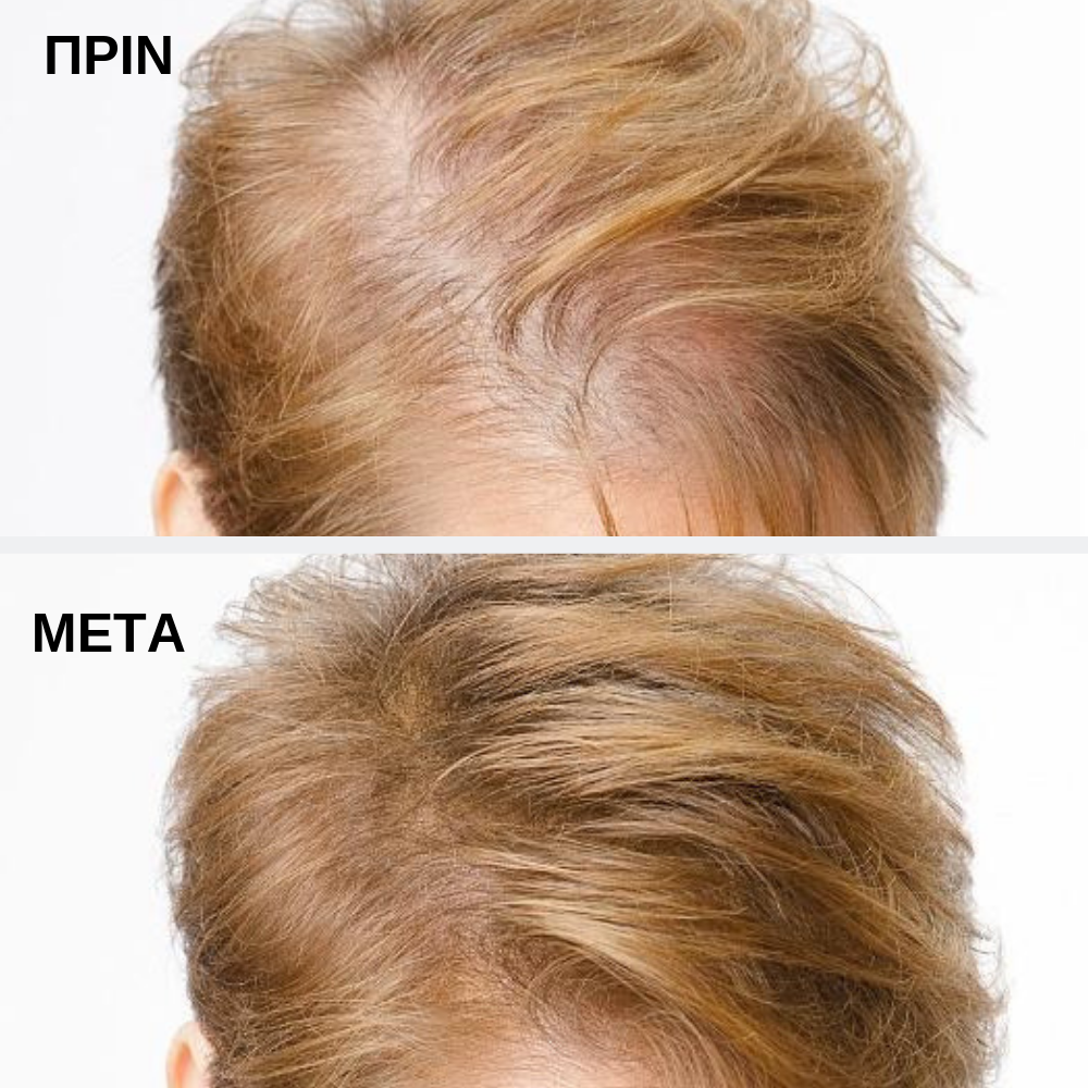 Toppik Hair Building Fibers Black 12gr - Image 6