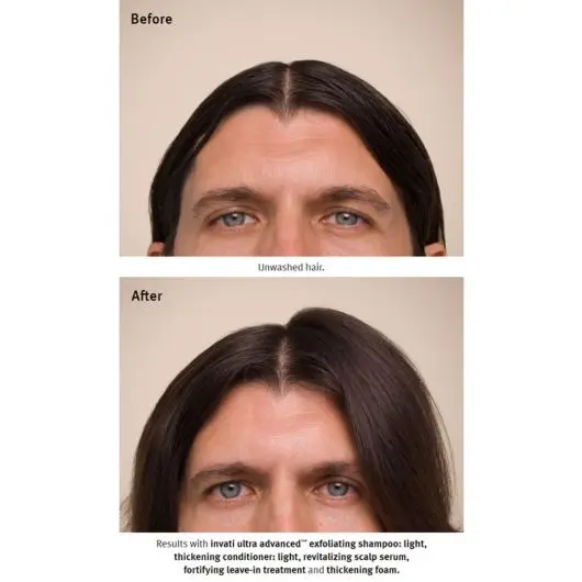 Aveda Invati Ultra Advanced Revitalizing Scalp Serum 150ml - Image 5