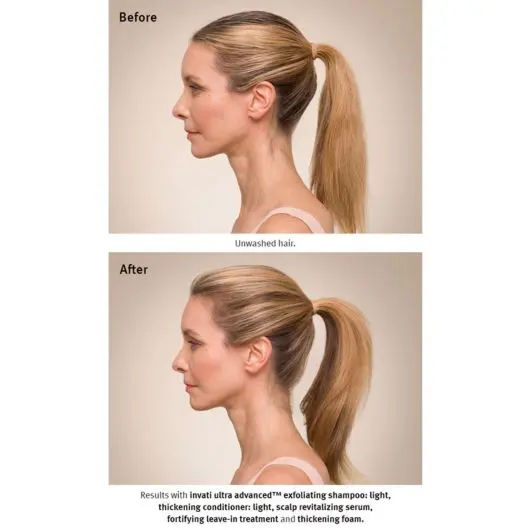 Aveda Invati Ultra Advanced Revitalizing Scalp Serum 150ml - Image 3