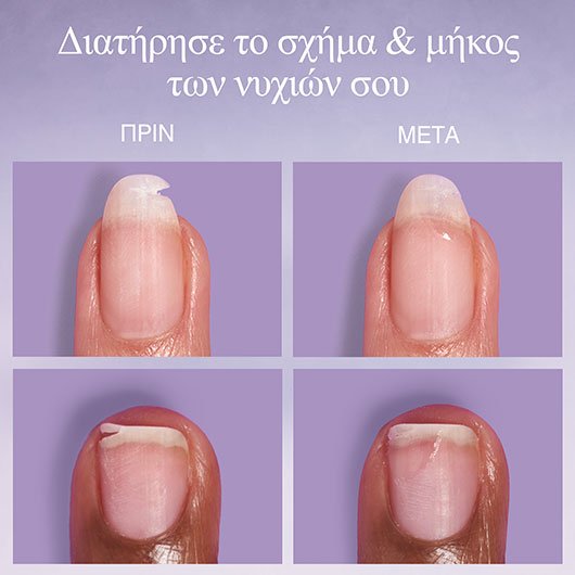 Essie Break Fix 7ml - Image 3